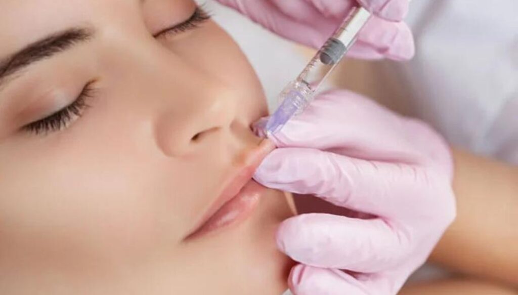 Aftercare Tips for Russian Lip Filler Patients