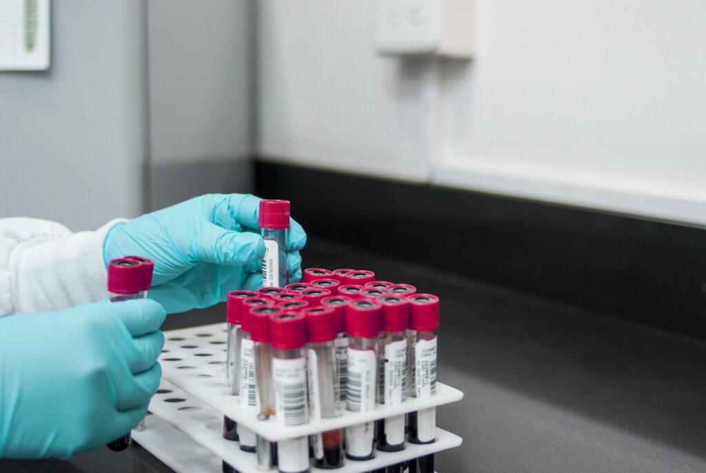 Earn Your Bloodborne Pathogen