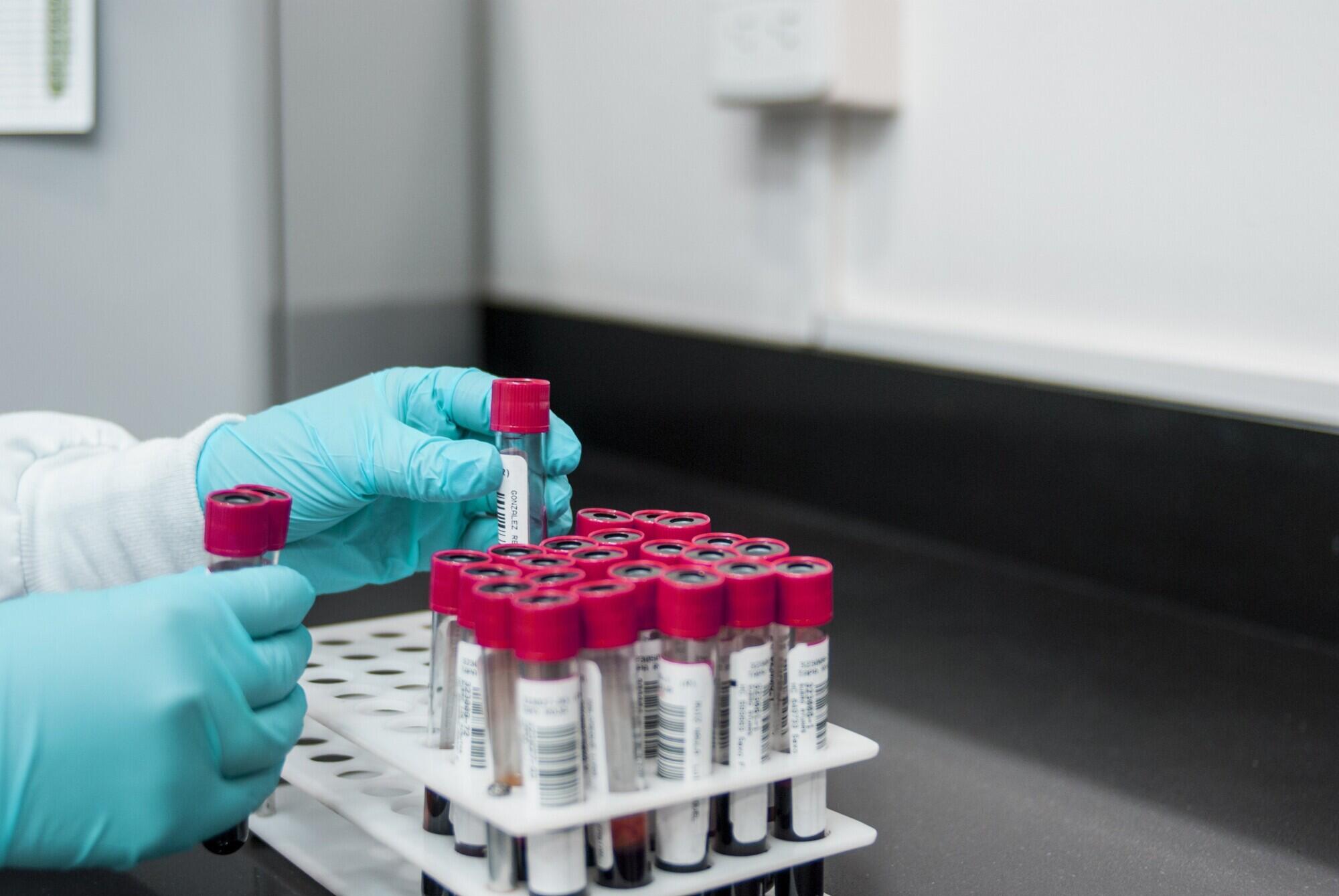 Earn Your Bloodborne Pathogen
