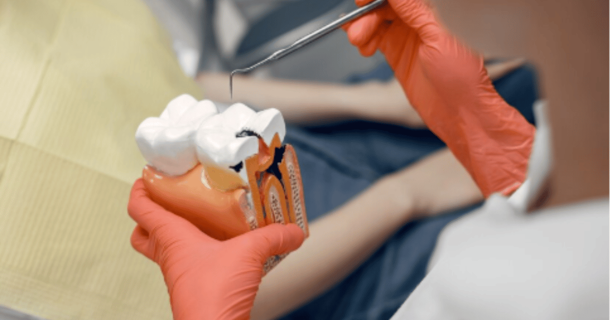 root canal recovery