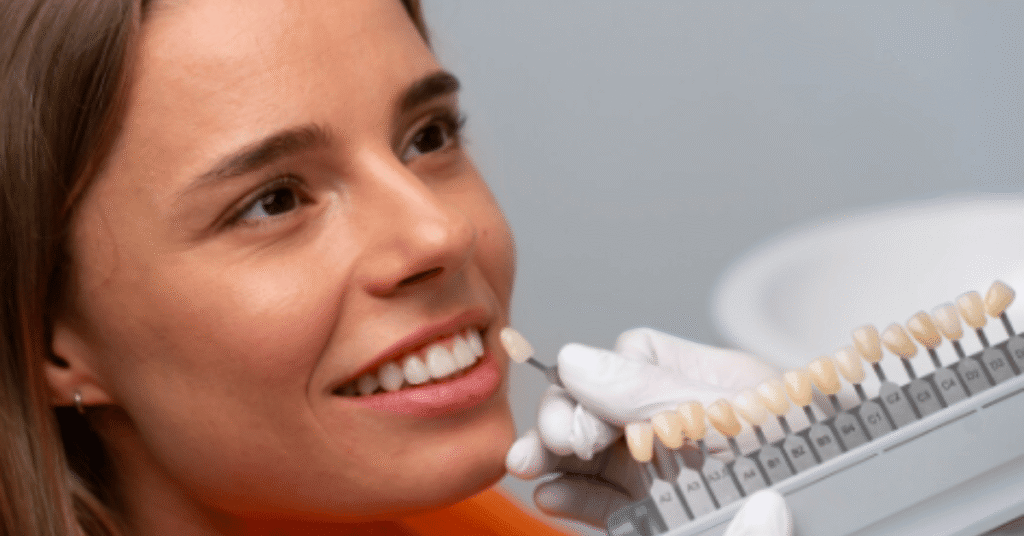 ceramic teeth cap