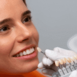 ceramic teeth cap
