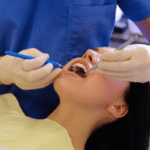 gum graft