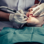 gum graft surgery